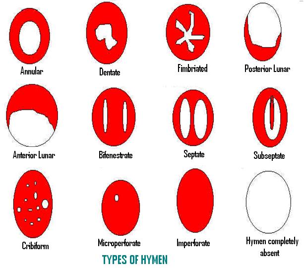 different vagina shapes and sizes